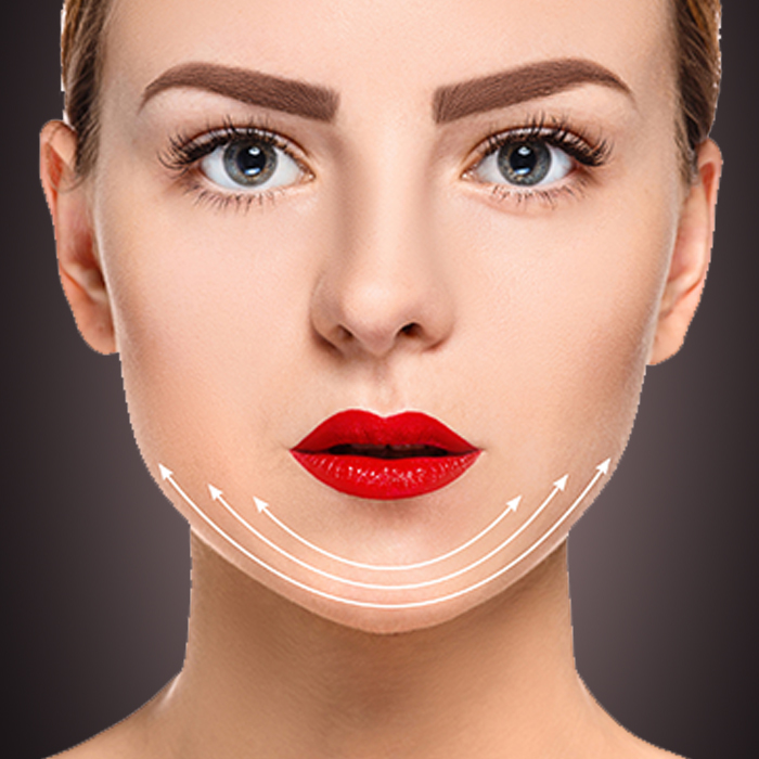 chin surgery