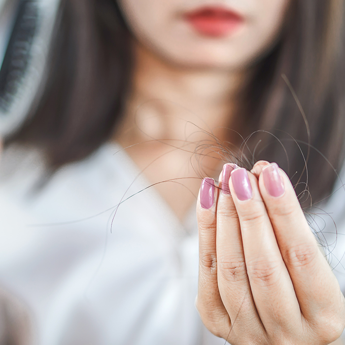 female hair loss